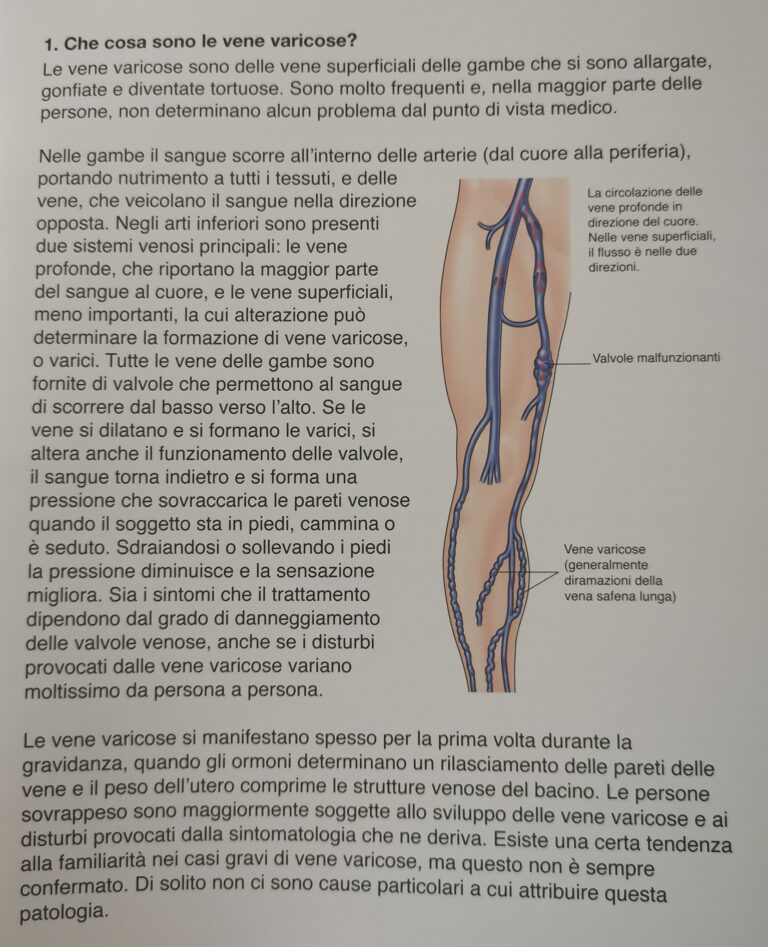 TRATTAMENTO VENE E CAPILLARI AD OLBIA